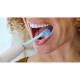 Philips Sonicare HX9042/87 Premium Plaque Defence